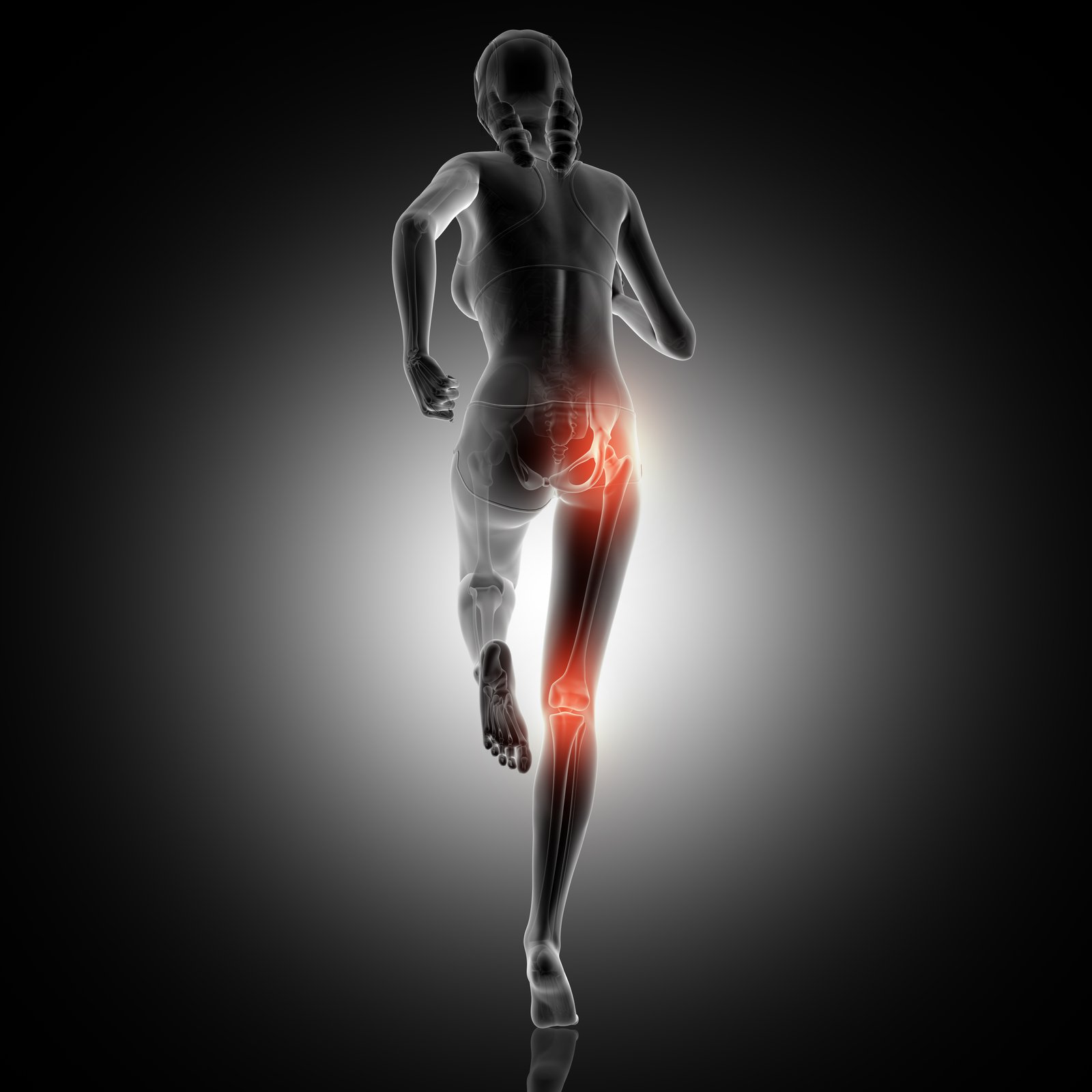 sciatica treatment at Ishwaryam Spine & Joint Clinic.